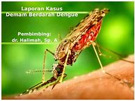 Laporan Kasus Dbd Anak